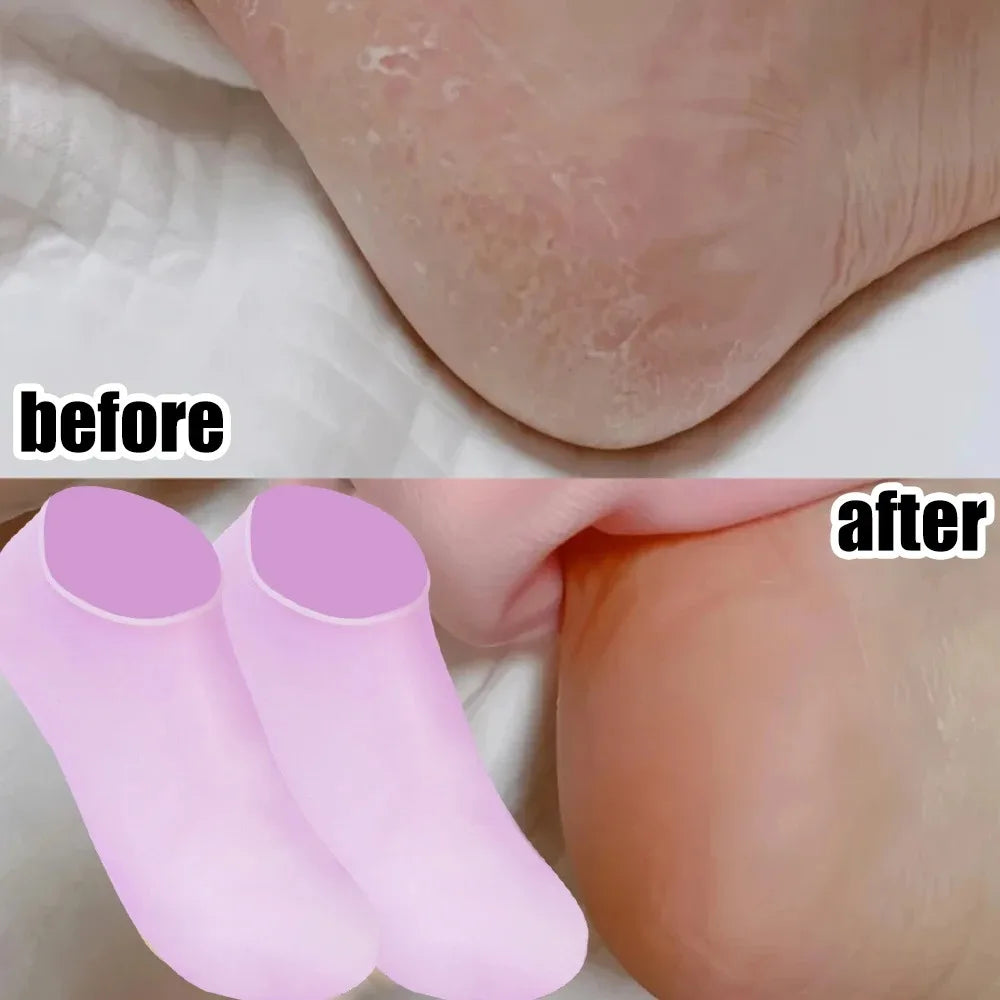 Spa Massage Silicone Moisturizing Foot Socks
