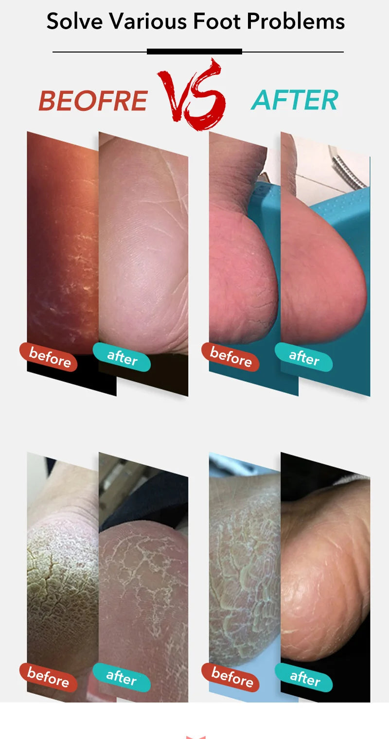 Feet Care Tools