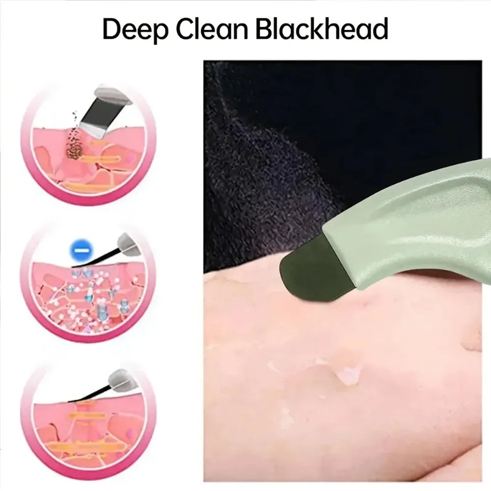Blackhead and Whitehead Removal Tool