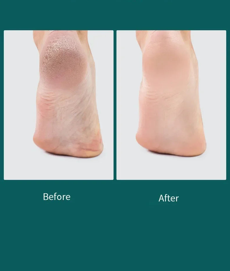 Double Sided Foot Care Tools